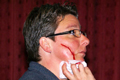 04 snee wang aangezichtsletsels